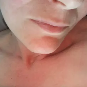 Linda, 35 år